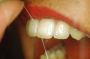 floss2.jpg